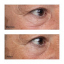 High Potency Growth Factor Firming & Lifting Eye Serum  PERRICONE MD
