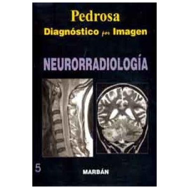 NEURORRADIOLOGIA