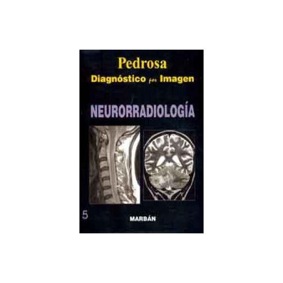 Neurorradiologia