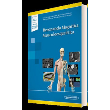 RESONANCIA MAGNETICA MUSCULOESQUELETICA (+E-BOOK)