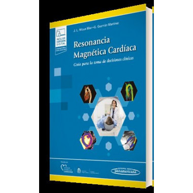 RESONANCIA MAGNETICA CARDIACA