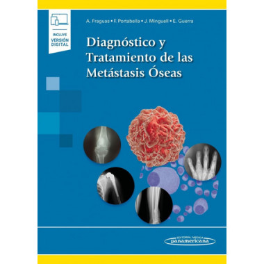 DiagnÃƒÂ³stico y Tratamiento de las MetÃƒÂ¡stasis ÃƒÂ“seas (incluye versiÃƒÂ³n digital)