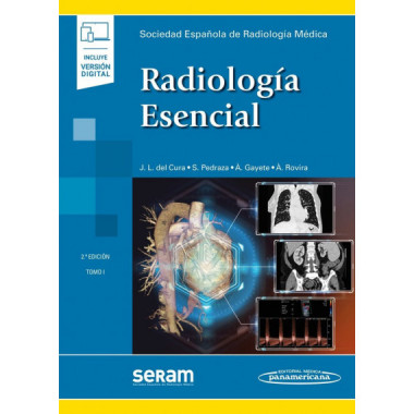 SERAM:RadiologÃƒÂ†a Esencial 2Ed, 2T+e