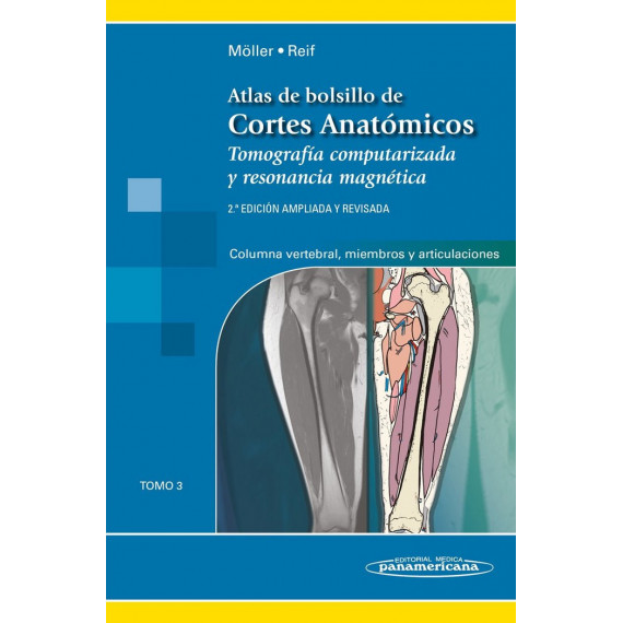 MOLLER:Atlas cortes anatomicos, 2aEd T3