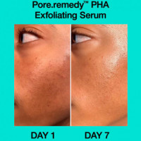Pore Remedy Pha Exfoliating Serum Serum Exfoliante Pha  DR. JART +
