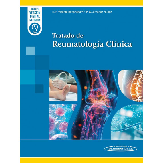 Tratado de Reumatologia Clinica   2025