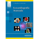 Ecocardiografia Avanzada
