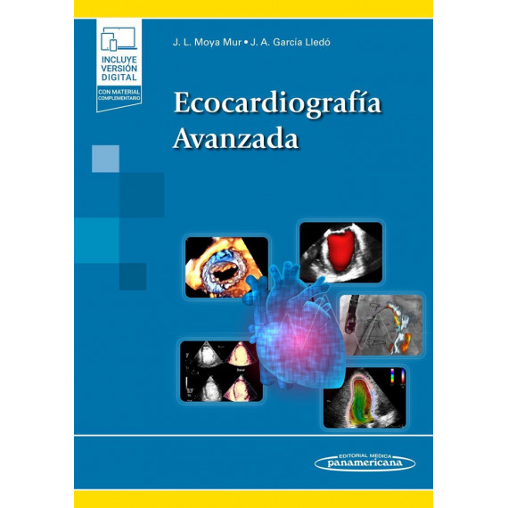 Ecocardiografia Avanzada
