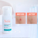 Cleanance Comedomed
cuidado Intensivo Anti-imperfecciones  AVÈNE