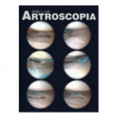 ARTROSCOPIA