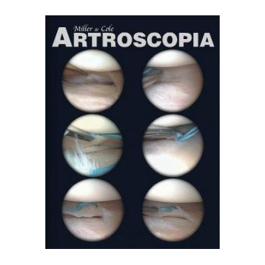 ARTROSCOPIA