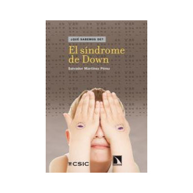 El s�ndrome de Down