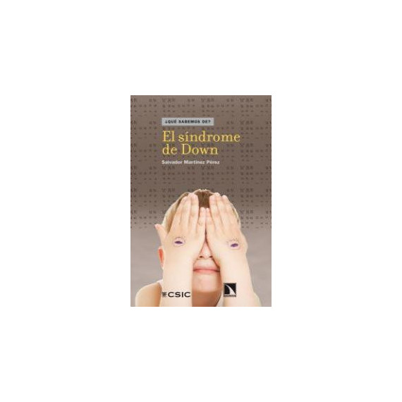 El s�ndrome de Down
