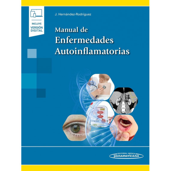 Manual de Enfermedades Autoinflamatorias