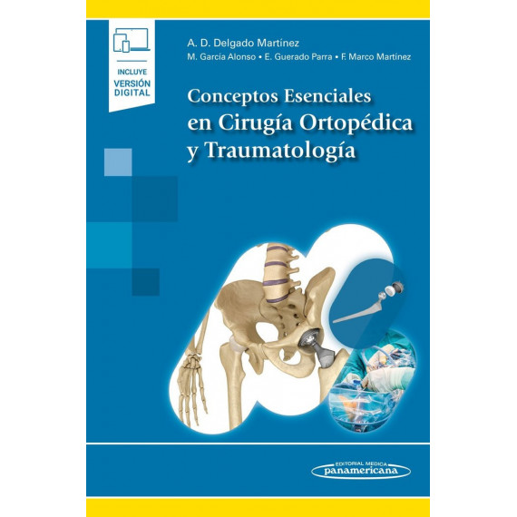 CONCEPTOS ESENCIALES EN CIRUGIA ORTOPEDICA Y TRAUMATOLOGIA