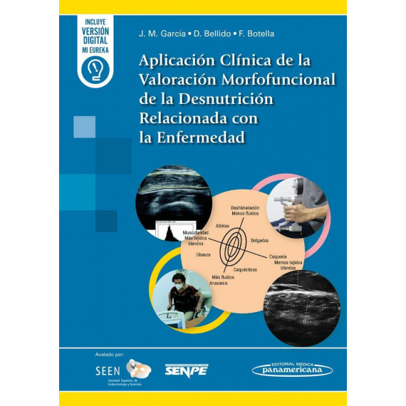 APLICACION CLINICA DE VALORACION MORFOFUNCIONAL DE DESNUTRI