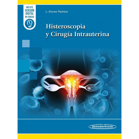 HISTEROSCOPIA Y CIRUGIA INTRAUTERINA