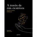 A TRAVES DE MIS CICATRICES