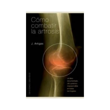 C�mo combatir la artrosis