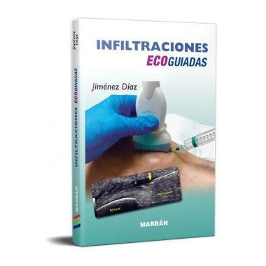 Infiltraciones Ecoguiadas