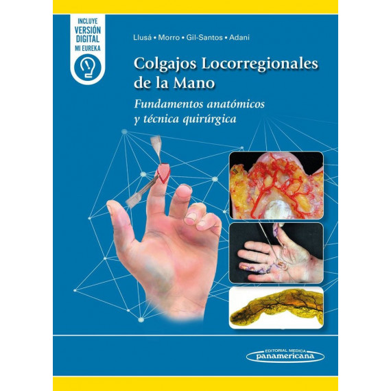 Colgajos Locorregionales de la Mano   2025