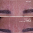 Rénergie Collagen Lift-xtend
crema Facial con Colágeno  LANCOME