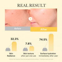 Kojic Acid Turmeric Gold Jelly Gel Mask
mascarilla Facial Iluminadora  MEDICUBE