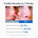 Zero Pore Pads
Discos Exfoliantes