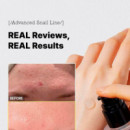 Advanced Snail 96 - Mucin Power Essence
tratamiento Regenerador - Antiarrugas  COSRX