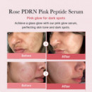 Pdrn Pink Peptide Serum
serúm Hidratante - Reafirmante  MEDICUBE