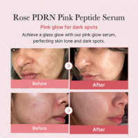 PDRN Pink Peptide Serum
Serúm Hidratante - Reafirmante