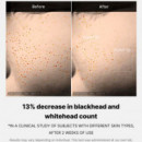 Zero Pore One-day Serum
sérum Facial Exfoliante - Limpiador  MEDICUBE