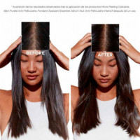 Serum Cellulaire Nuit Anti-Pelliculaire Intensif
Tratamiento Anticaspa