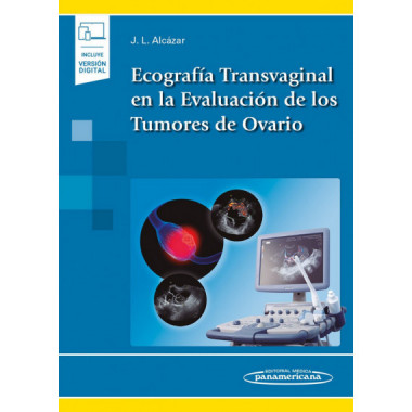 Ecograf�a Transvaginal en la Evaluaci�n de los Tumores de Ovario (incluye versi�n digital)