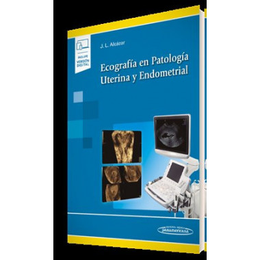 Ecograf�a en Patolog�a Uterina y Endometrial