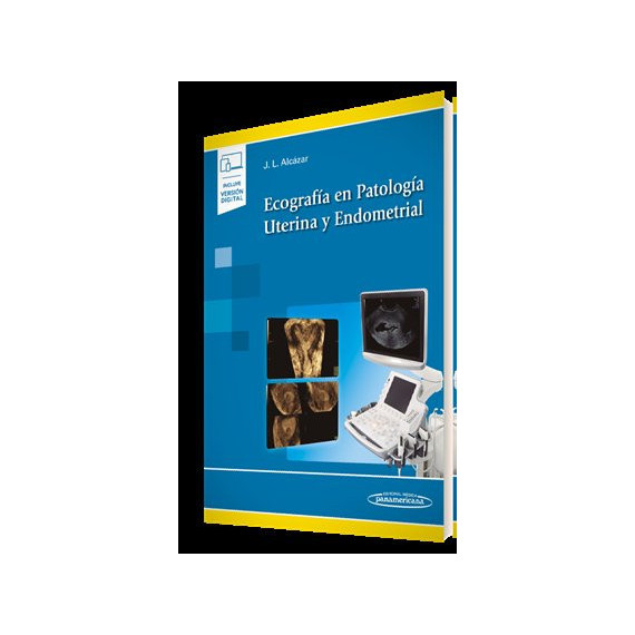 Ecograf�a en Patolog�a Uterina y Endometrial