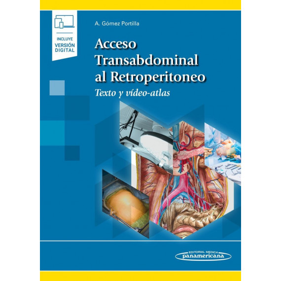 Acceso Transabdominal al Retroperitoneo (incluye versi�n digital)