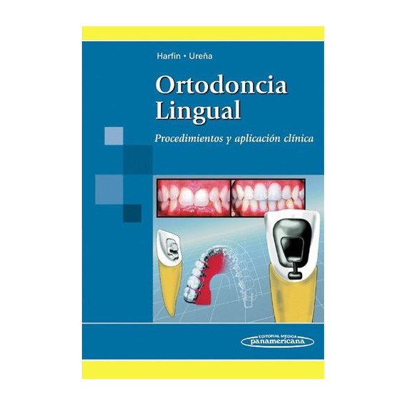HARFIN-URE�A:Ortodoncia Lingual