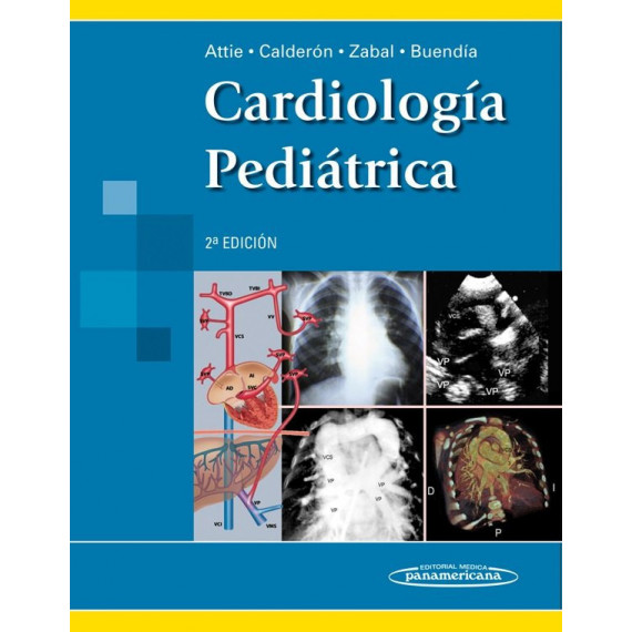 ATTIE:Cardiolog�a Pedi�trica 2aEd