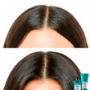 Scalp Advanced Champú Anti Malestar  LOREAL PROFESSIONNEL