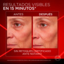 L'Oreal Revitalift Láser Ojos, 15ml