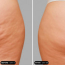 Unicbody Slim Action X4
TRATAMIENTO Corporal Tonificante  UNICSKIN