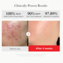 Red Succinic Acid Panthenol Pads
Discos Faciales Exfoliantes