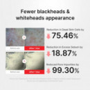 Hypochlorous Acid Rice Peel Shot
Serum Facial Exfoliante - Limpiador
