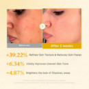 Kojic Acid Turmeric Toner
Tónico Suavizante De Cúrcuma Ácida Para Rostro Y Cuerpo.