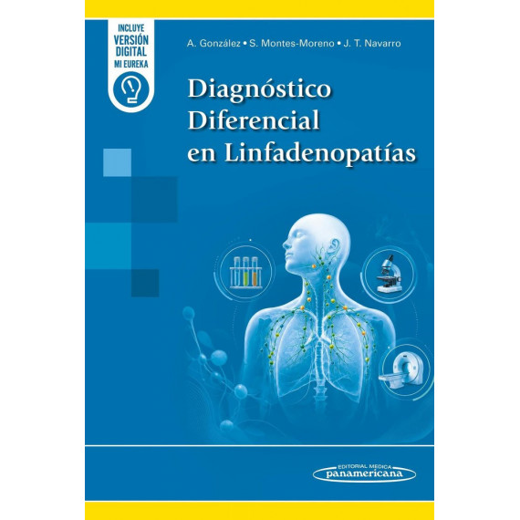DIAGNOSTICO DIFERENCIAL EN LINFADENOPATIAS