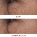 PERRICONE MD Cold Plasma Plus+ Eye 15ML