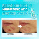 No.1 Pantothenic B5 Active Soothing Serum
Sérum Facial Calmante y Seborregulador