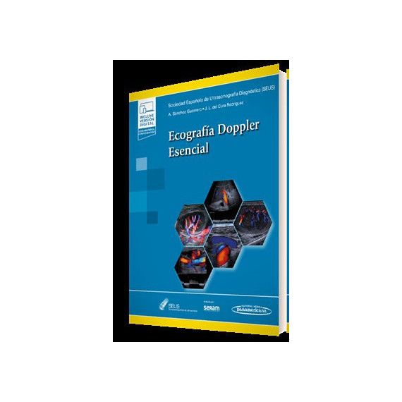 Ecografia Doppler Esencial