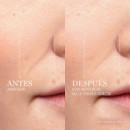 Rénergie Hcf Triple Serum  LANCOME